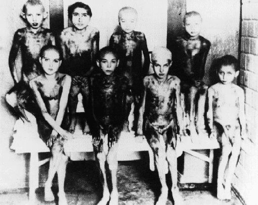 Enfants à Auschwitz, victimes des  "expérimentations médicales" 